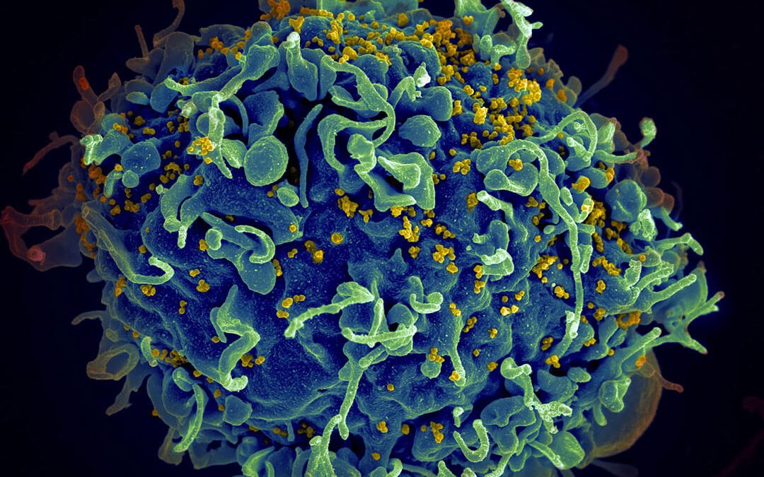 Virus Hiv